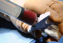 Campanha realiza cadastro para Medula Óssea