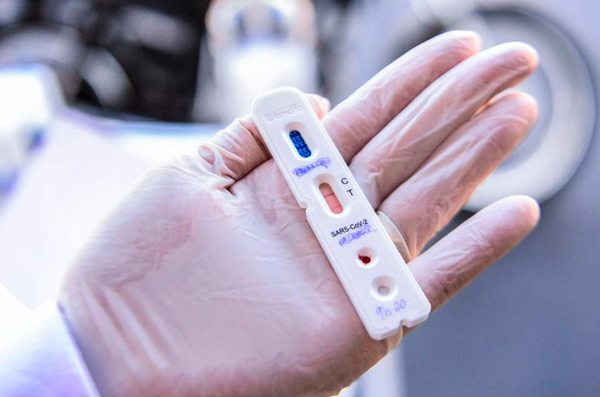 Alerta_para_a_qualidade_dos_testes_rápidos_do_coronavírus