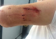 Em São João, rapaz agride idoso de 69 anos com bloco de concreto