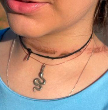 Após acidente, Elektro começa a retirar cabos irregulares dos postes